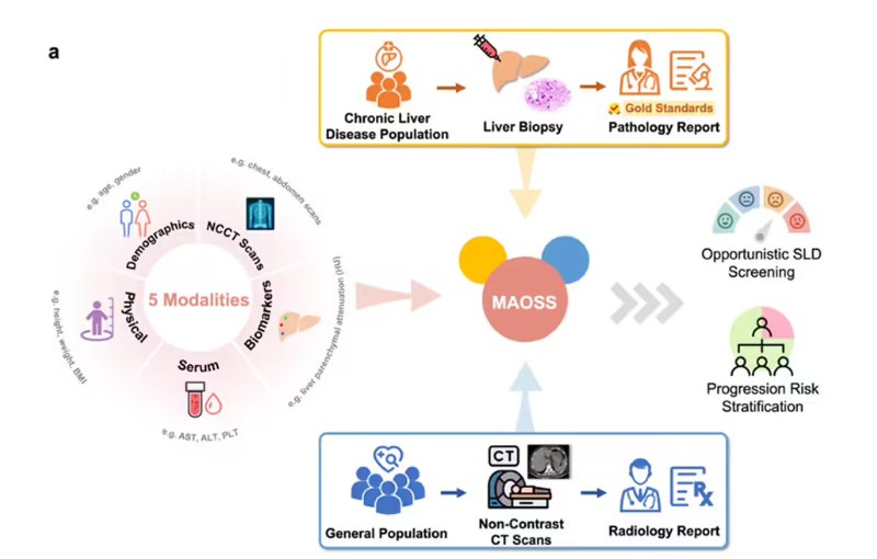 阿里达摩院发布 MAOSS 模型：利用 AI 筛查脂肪肝，高风险检出率翻倍阿里巴巴达摩院宣布，联合中国医科大学附属盛京医院、南京大学附属鼓楼医院等多家机构，共同研发出名为 MAOSS 的脂肪肝筛查 AI 模型